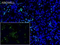 DNMT3A Recombinant Rabbit Monoclonal Antibody