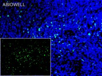 DNMT3A Recombinant Rabbit Monoclonal Antibody