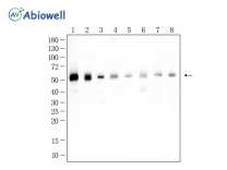 ATP5A1 Recombinant Rabbit Monoclonal Antibody