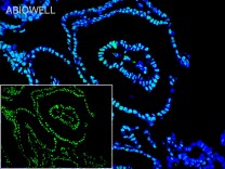 PPARA Rabbit Polyclonal Antibody