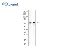 Smad3 Recombinant Rabbit Monoclonal  Antibody