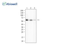 TPH2 Recombinant Rabbit Monoclonal Antibody