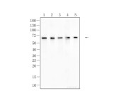 NFκB-p65 Recombinant Rabbit Monoclonal Antibody