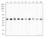 PSMD14 Recombinant Rabbit Monoclonal Antibody