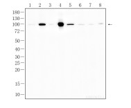 ALDH1L1 Recombinant Rabbit Monoclonal Antibody