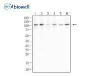 HDAC7 Recombinant Rabbit Monoclonal Antibody