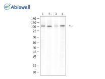 HDAC7 Recombinant Rabbit Monoclonal Antibody