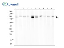 FOXP1 Recombinant Rabbit Monoclonal Antibody