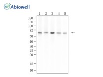 SUOX Recombinant Rabbit Monoclonal Antibody