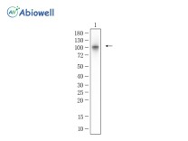 CaSR Recombinant Rabbit Monoclonal Antibody