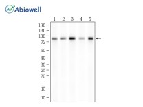 DRP1(Phospho Ser616) Recombinant Rabbit Monoclonal Antibody