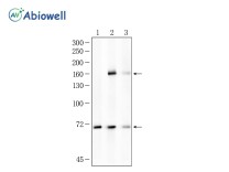 NEFH Recombinant Rabbit Monoclonal Antibody