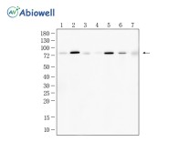 ACSS2 Recombinant Rabbit Monoclonal Antibody