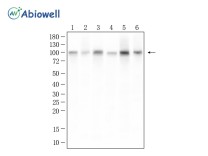 SP1 Recombinant Rabbit Monoclonal Antibody