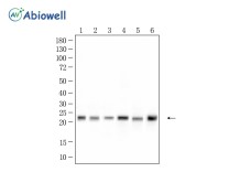 BTF3 Rabbit Monoclonal Antibody