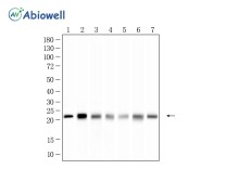 BTF3 Rabbit Monoclonal Antibody