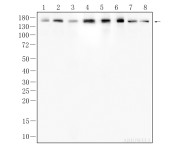 Flt-1 Recombinant Rabbit Monoclonal Antibody