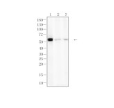 WT1 Recombinant Rabbit Monoclonal Antibody