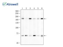 CD206 Recombinant Rabbit Monoclonal Antibody