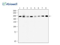 DNMT1 Recombinant Rabbit Monoclonal Antibody