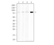 CHAT Recombinant Rabbit Monoclonal Antibody