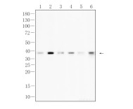 CD40L Recombinant Rabbit Monoclonal Antibody