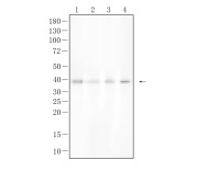 CD40L Recombinant Rabbit Monoclonal Antibody