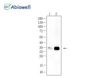 AQP1 Recombinant Rabbit Monoclonal Antibody