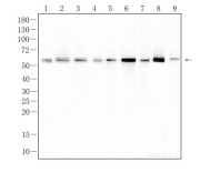 AKT1 Recombinant Rabbit Monoclonal Antibody