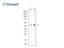 GAP43 Recombinant Rabbit Monoclonal Antibody