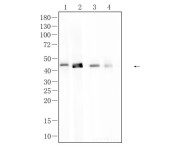 Cytokeratin 19 Recombinant Rabbit Monoclonal Antibody