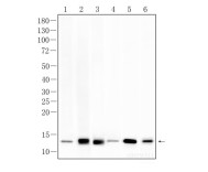 4EBP1 Recombinant Rabbit Monoclonal Antibody