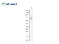 EGR1 Recombinant Rabbit Monoclonal Antibody