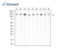 WWP2 Rabbit Polyclona Antibody