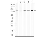 TAK1(Phospho Thr187) Rabbit Polyclonal  Antibody