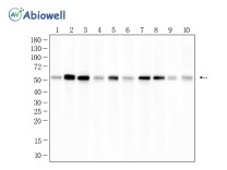 PPM1B Rabbit Polyclonal Antibody