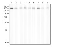 ABCA1 Rabbit Polyclonal Antibody