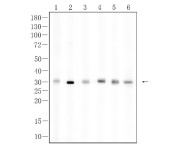 NGF Rabbit Polyclonal Antibody