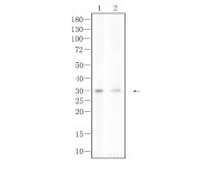 NGF Rabbit Polyclonal Antibody