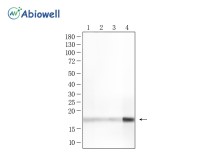 Prolactin Rabbit Polyclonal Antibody