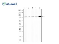 PROS1 Rabbit Polyclonal Antibody