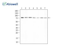 PROS1 Rabbit Polyclonal Antibody