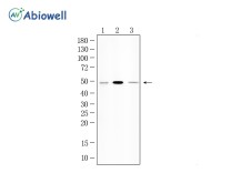 ADRB2 Rabbit Polyclonal Antibody